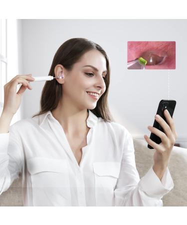 ScopeAround Ear Spoon with Camera | Otoscope Accessories | 9 Disposable Speculums, 4 Ear Picks, 1 Pack Q-Tips | 3.9mm Diameter Lenses - Buy Online on GoSupps.com