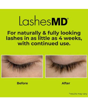 LashesMD Eyelash Growth Serum 0.135 oz - Enhances Stronger, Thicker Lashes & Brows - Paraben & Cruelty Free - Clinically Formulated with Peptides & Botanicals - Buy Online on GoSupps.com