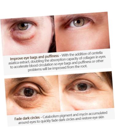 Didiseaon Makeup Accessories Eye Creams Dark Circle Cream for Eye Anti Wrinkle Cream Eye Crean Essence Eye Cream Care White Accessories Moisturizing Eye Cream - Buy Online on GoSupps.com