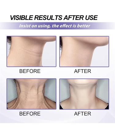 Neck Cream - Anti-Aging Tightening & Moisturizing Cream for Neck & Cleavage | Double Chin Reduction - Buy Online on GoSupps.com