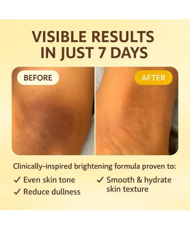 ADEUS Banana Cream Dark Spot Correcting Brightening Cream with Banana Extract Niacinamide & Alpha Arbutin | For Underarms Bikini Line Buttocks & Body 100g / 3.52 oz (1) - Buy Online on GoSupps.com