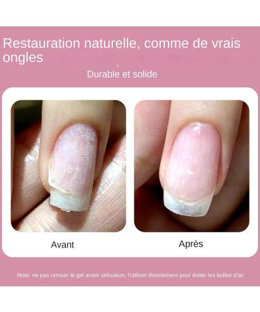 Repairing Treatment for Broken Nails - 5g File Brush and Tweezers | Strengthening Nail Gel | Daily Manicure for Women and Girls Repairing Cracks Daily Maintenance - Buy Online on GoSupps.com