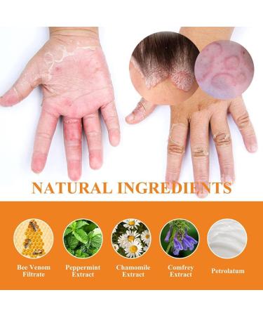 HePbAK Youth Bee Venom Psoriasis Treatment Cream | Professional Soothing Moisturizer for All Skin Types | 3PCS - Buy Online on GoSupps.com