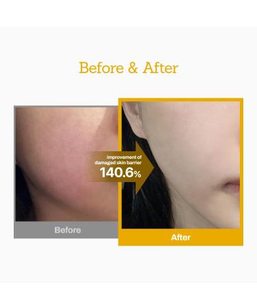 MEDITHERAPY Jojoba Ceramide Barrier Cream | Intensive Repair & Long-Lasting Hydration | Boost Skin Strength | EWG Green Grade | 3.38 fl. oz - Shop Internationally - Buy Online on GoSupps.com