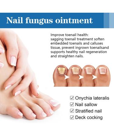  EXQST LEFUN Paronychia Gel Nail Repair Pen Multi-Use for Damaged Faded Nails Repair Thick Gel Nail Repair - Buy Online on GoSupps.com