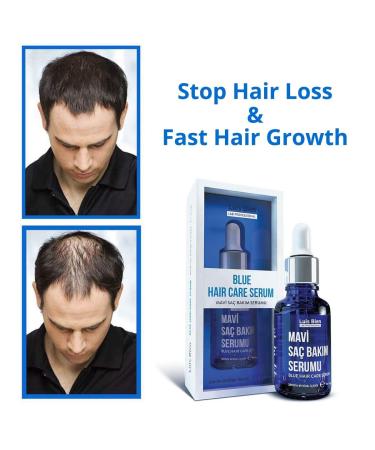 Luis Bien Hair Growth Serum - Accelerate Growth & Prevent Hair Loss | Vitamin E Oil | 50ml for Men & Women - Buy Online on GoSupps.com