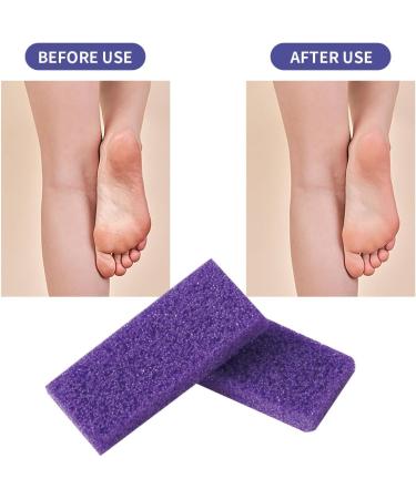 Disposable Foot Scrubber Pumice Pads | Effective Pedicure & Callus Remover for Smooth Feet - Buy Online on GoSupps.com