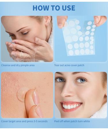 Buy Pimple Patches for Face - Hydrocolloid Acne Strips with Salicylic Acid & Tea Tree Oil - Effective Blemish & Pore Cleansing for All Skin Types - Buy Online on GoSupps.com