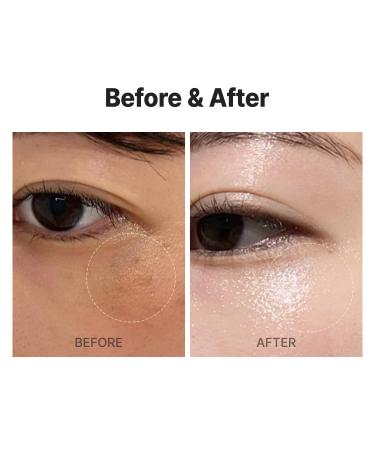 MEDITHERAPY VITA REAL Shot Clear Patch - Dark Spot & Acne Care Hydrocolloid Patch with Pure Vitamin C for Brightening | Korean Skincare (6EA - Buy Online on GoSupps.com