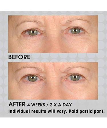 NassifMD Under Eye Smoother - Anti Aging Eye Cream for Dark Circles & Puffiness Firming Eye Serum for Women - Buy Online on GoSupps.com