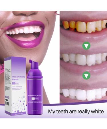 GFOUK Oral Crystal Cleaning Mousse - Tooth Whitening & Stain Removal (3PCs) | Gfuel Oral Crystal Mousse - Buy Online on GoSupps.com