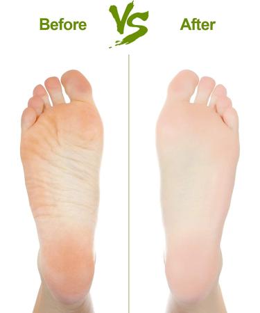 2PCS Natural Pumice Stone for Feet - Callus Remover and Exfoliator for Smooth Skin - Lava Pedicure Tool for Feet and Hands - Buy Online on GoSupps.com