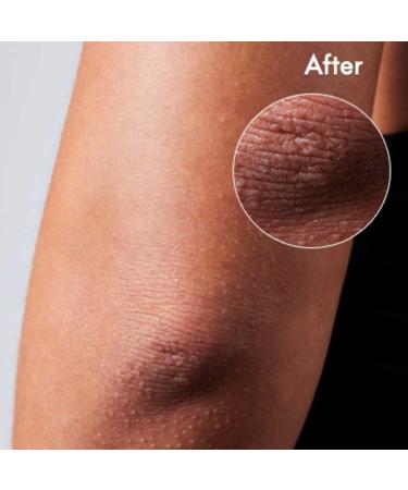 Lanolips 101 Dry Skin Super Cream - Hydrating Whipped Body Cream for Face + Body - Triple Lanolin, Almond Oil, Shea Butter & Vitamin E - 2.02 oz - Clean, Cruelty-Free - Buy Online on GoSupps.com