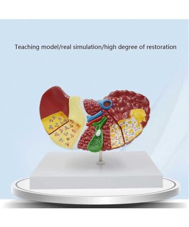 Liver Damage ical Model Liver Pathology Models Teaching Aids - 22.5 * 17 * 16CM - Buy Online on GoSupps.com