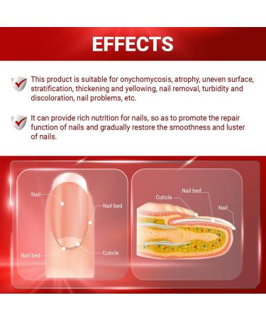 Abera Fungus Treatment for Toenail & Fingernail Repair | Nail Renewal Liquid & Eyemask Set - Effective Solution for Discolored & Damaged Nails - Buy Online on GoSupps.com