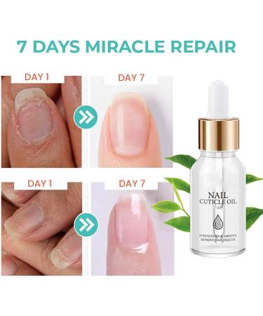 Oveallgo Huile riche en vitamines pour cuticules et cuticules des ongles s rum fortifiant pour la croissance des ongles renforce l'huile des ongles favorise la croissance rapide des ongles (mixte) - Buy Online on GoSupps.com
