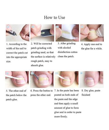 100stk Toenail Correction Stickers for Ingrown Toenails | Foot Care & Pedicure Solution - Buy Online on GoSupps.com