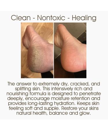 Montana Snow Butter Organic body butter, Whipped Body Butter Dry Skin - Body Butter Cream Without Feeling Greasy - Whipped Shea Butter Cream for Skin Mango Butter Cream (Unscented) - Buy Online on GoSupps.com