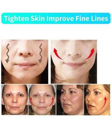 Silicone Double Chin Reducer V Face Firming Belt for Tightening Skin - Prevent Sagging - Buy Online on GoSupps.com