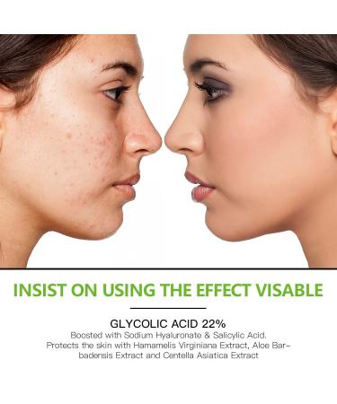 Glycolic Acid Pads 20% with Salicylic Acid & Hyaluronic Acid - Deep Cleaning for Blackheads Pore Reduction & Balanced Skin - 50 Pads | Shop Internationally - Buy Online on GoSupps.com