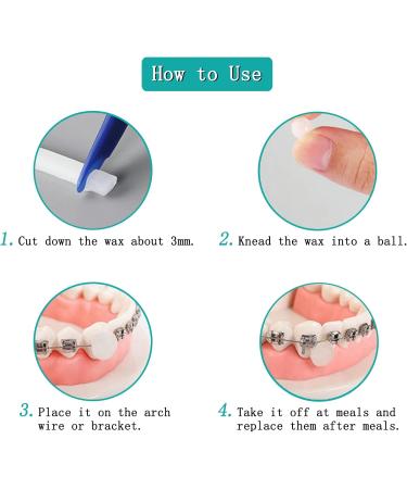 8 Boxes of Orthodontic Dental Wax | Pain Relief Strips for Braces | International Shipping Available - Buy Online on GoSupps.com