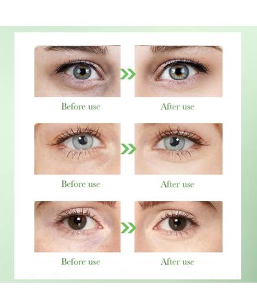 Aloe Vera Eye Patches for Dark Circles - Collagen under Eye Mask - Eye Bags Remover - Lasting Moisturizing - Relieves Dry Eyes - Eye Care Products - Buy Online on GoSupps.com