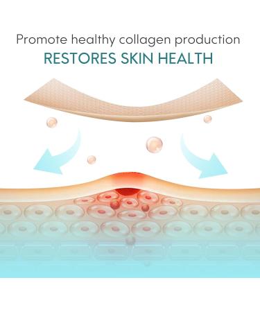 Silicone Scar Roller Tape - Reusable 4m x 4.6cm for Scar Removal & Keloid Treatment - Ideal for Caesarean Scars & Facial Scarring - Buy Online on GoSupps.com
