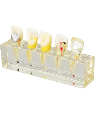 Endodontic Model - Stable Portable Dental Pulp Model for Practice & Teaching | International Shipping - Buy Online on GoSupps.com
