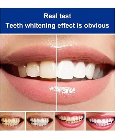 SP-4 Brightening & Stain Removing Toothpaste - Probiotic Whitening Natural Teeth Whitener (2 Pcs) - International Shipping Available - Buy Online on GoSupps.com