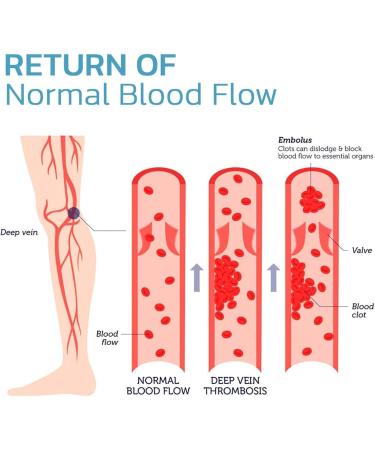 Massage Socks for Women - Magnetic Foot Care & Reflexology Socks | High Elasticity Foot Massage Socks for Home Use - Buy Online on GoSupps.com