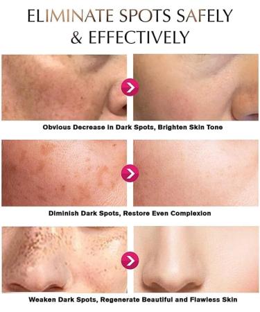 Kwiphiny Snow Bleach Cream Snow Bleach Cream for Private Part Intimate Areas Underarm Neck Knees Elbows Dark Skin Lightening Cream Dark Spot Remover Cream Skin Lightening Bleaching Cream 3PCS - Buy Online on GoSupps.com