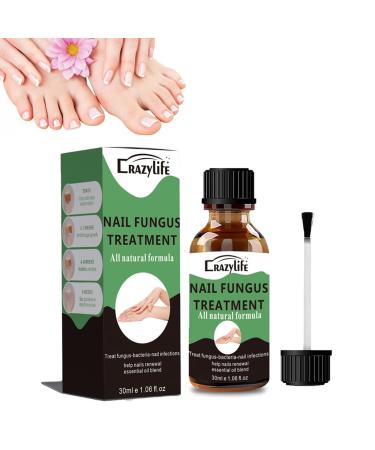 Nail Oil- Extra Nagel Oil for foot and fingernails grow in toe nail nail care serum for fragile nail care nail polish also with nail discoloration beautiful manicure 30ml - Buy Online on GoSupps.com