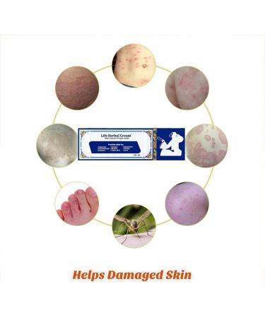 Life Herbal Cream with Vitamin D - Skin Relief for Itch, Inflammation, and Rashes - Buy Online on GoSupps.com