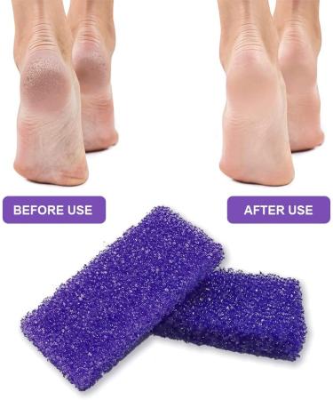 Pumice Stone for Feet - Disposable Purple Pedicure Scrubber (40 Count) - Exfoliator Sponge for Dead Skin Removal - Buy Online on GoSupps.com