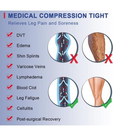 Beister Medical Compression Pantyhose 20-30mmHg for Men & Women - XXL Beige Waist High Support Tights for Varicose Veins & Edema - Buy Online on GoSupps.com