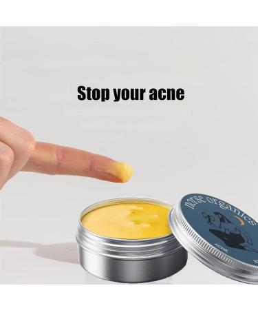 Norse Organics Acne Clearing Cream (2pcs) - Skin Nourishing Formula for Teens & Adults Redness Relief Repairs & Smooths Skin - Ideal for Men - Buy Online on GoSupps.com