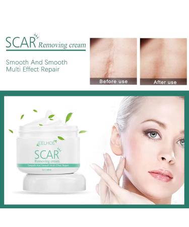 Skin Eternal Scar Removal Cream - Effective Stretch Mark and Scar Treatment for Men and Women - Great for Burns and Face Skin - One Size Fits All - Buy Online on GoSupps.com