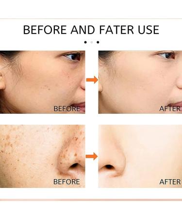 Saam Face Cream Dr Hancy White Spot Cream White Spot Cream China Saam Cosmetic Cream Moisturizing and Repairing Cream (5PCS) - Buy Online on GoSupps.com