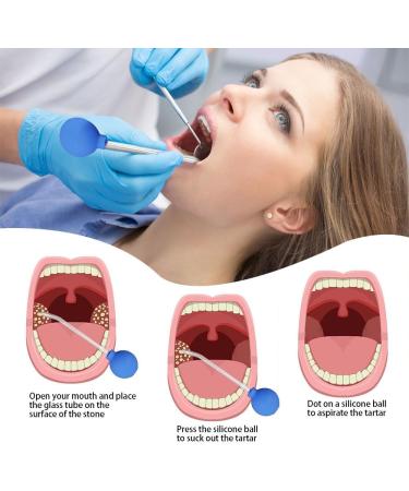 Best Tonsil Stone Remover Tool - Remove Almond Stones with Cupping Glass & Cleaning Brush for Oral Care | XPJBKC - Buy Online on GoSupps.com