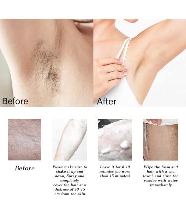 300ml Hair Removal Spray Foam for Women & Men - Painless Depilatory for Pubic Area, Bikini, Body, Legs, and Armpit - Natural Gentle Formula - 10.1 Fl Oz Cucumber - Buy Online on GoSupps.com