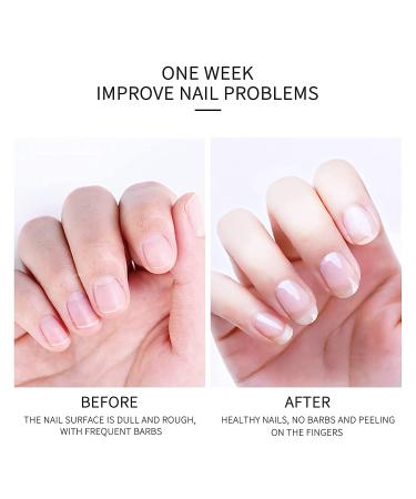 Morovan Nail Cuticle Oil Pen - 20PCS Nail Nourishment Gel with Natural Ingredients - Repair and Strengthen Damaged Nails - Buy Online on GoSupps.com