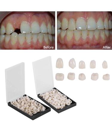 50pcs Temporary Dental Crowns - Realistic Porcelain Teeth for Front Molars | Oral Care & Restoration - Buy Online on GoSupps.com