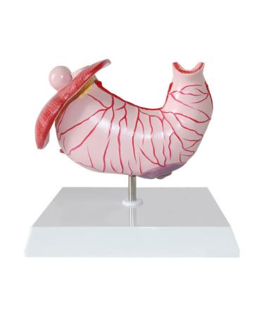 Human Stomach Lesion Model with Diaphragm Model Digestive System Model gastric Ulcer Model