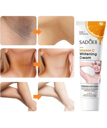 Vitamin C Skin Whitening Cream - Dark Spot Remover for Body & Intimate Areas | Lightening & Bleaching Solution - Buy Online on GoSupps.com