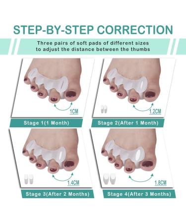 COSYSILK Adjustable Toe Spacers for Women - Small Size | Toe Separators for Plantar Fasciitis, Overlapping Toes & Feet Pain - Buy Online on GoSupps.com