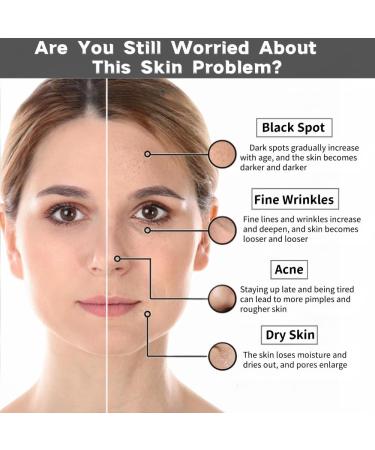 2% Alpha Arbutin + Hyaluronic Acid Facial Serum - Brightening Serum for Dark Spots Fade Acne Scars & Pigmentation - Helps Reduce The Appearance of Melasma & Blemishes - 1 Fl Oz (2PC) - Buy Online on GoSupps.com