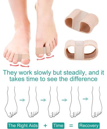 Bunion Correct Toe Spacers for Women Men - Toe Separators with Soft Gel Pads and Elastic Loops for Bunion Correction and Hammer Toe Straightening - Small Size - Buy Online on GoSupps.com