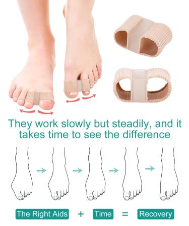 BLATOWN Toe Spacers for Bunion Correction - 2 Pair Set with Elastic Toe Loops and Soft Gel Pads (S+L) - Buy Online on GoSupps.com