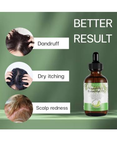 Rosemary Oil For Hair Growth Skin Care Eyelashes & Eyebrows. Rosemary Oil Stimulates & Strengthens Hair Growth Oil Pure Rosemary Essential Oil Hair oil For Men & Women (60ml) - Buy Online on GoSupps.com
