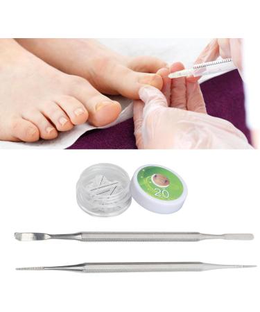 Ingrown Toenail Treatment Kit 10 20mm Strips Ingrown Toenail Corrector Tool Reduces Discomfort for Pedicure Shop - Buy Online on GoSupps.com